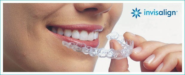 invisalign-header-1