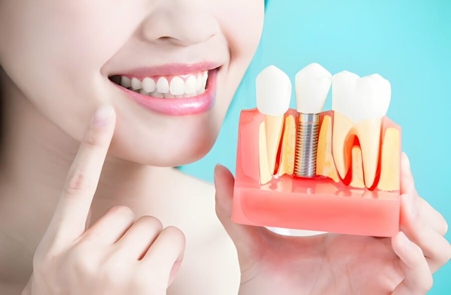 How To Choose The Right Dental Implants In Missouri_FI