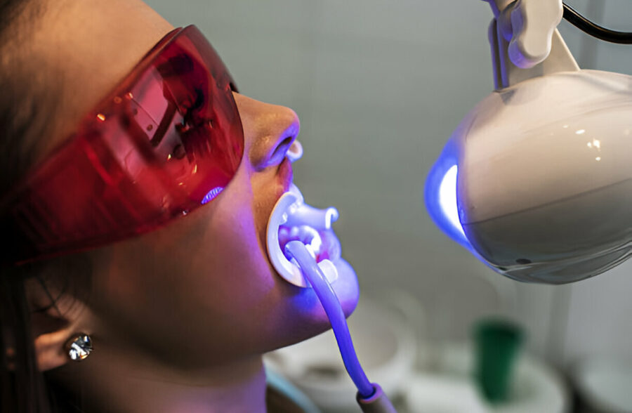Teeth Whitening in Branson, MO: Comparing In-Office vs. At-Home Treatments at Branson Dental Center_1