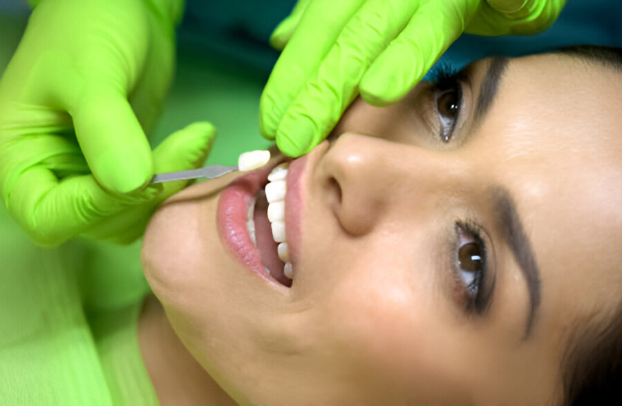 The Benefits of Porcelain Veneers for a Flawless Smile in Branson, MO