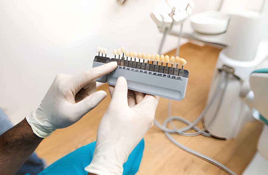 Porcelain Veneers in Branson, MO: Why Patients Trust Branson Dental Center_FI